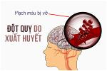 dot-quy-do-xuat-huyet
