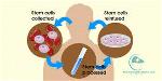 stem-cell
